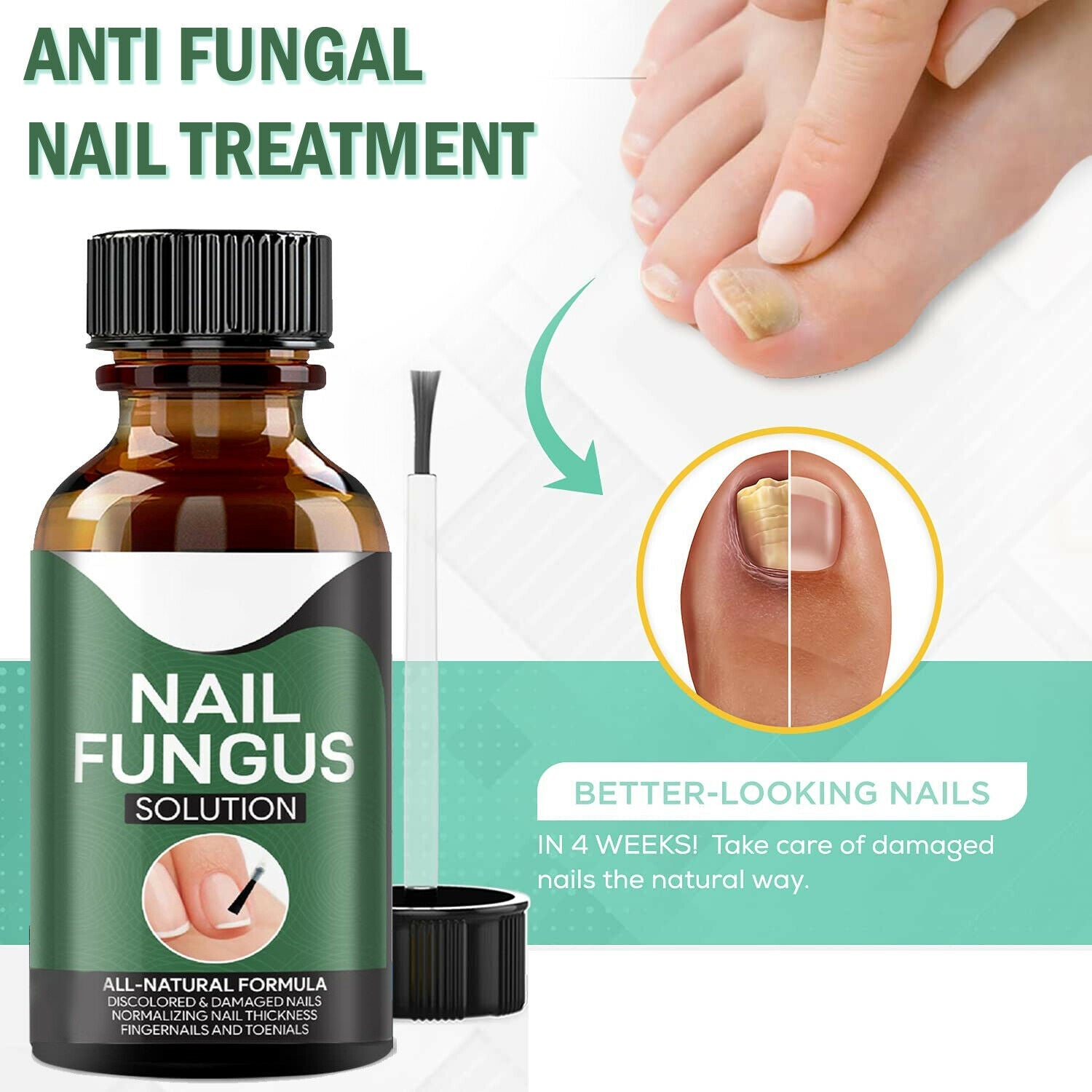 Anti-Pilz Nagel Treatment