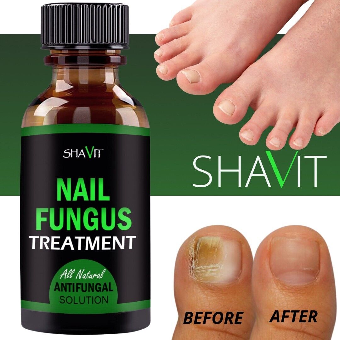 Anti Nagel Pilz Treatment Extra Stark