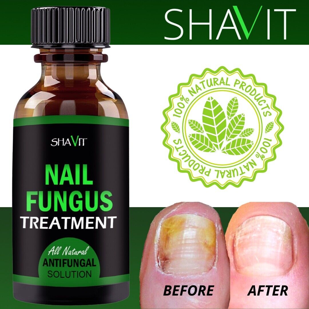 Anti Nagel Pilz Treatment Extra Stark