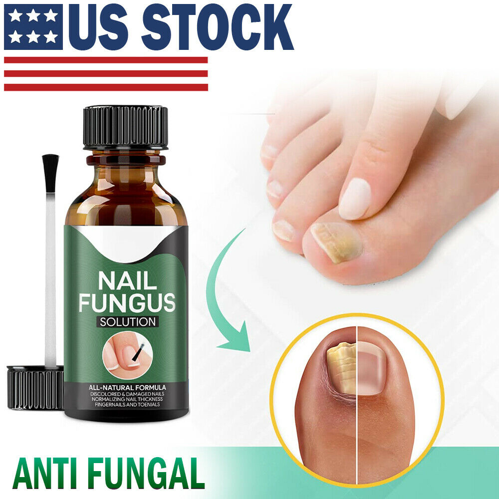 Anti-Pilz Nagel Treatment
