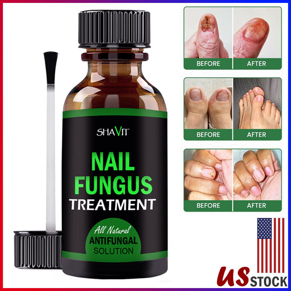 Anti Nagel Pilz Treatment Extra Stark