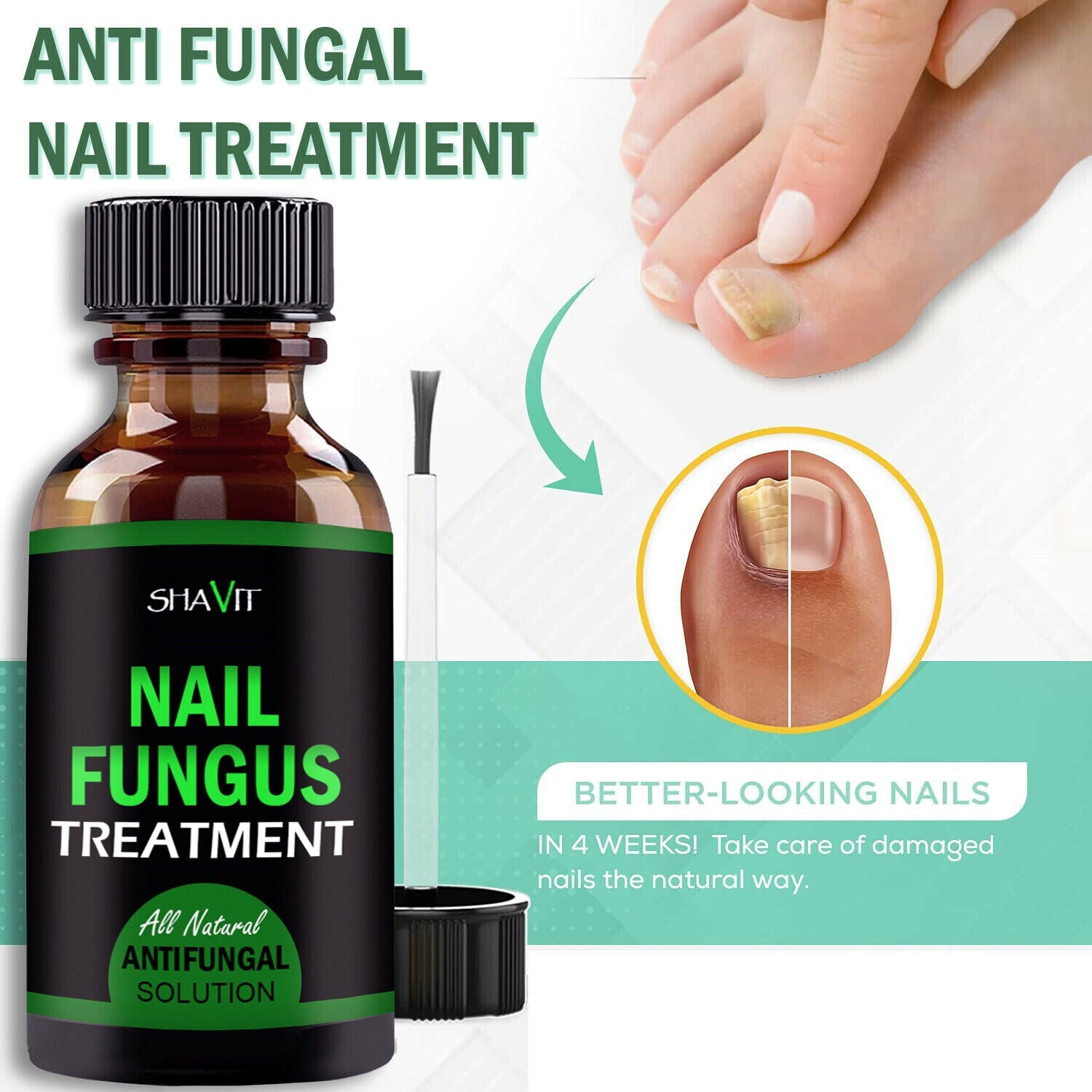 Anti Nagel Pilz Treatment Extra Stark